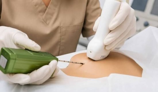 trucut mastologia